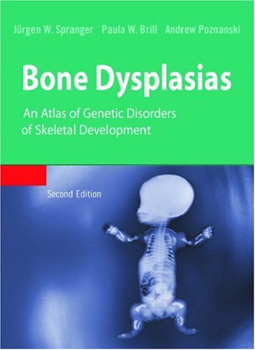 Bone Dysplasias