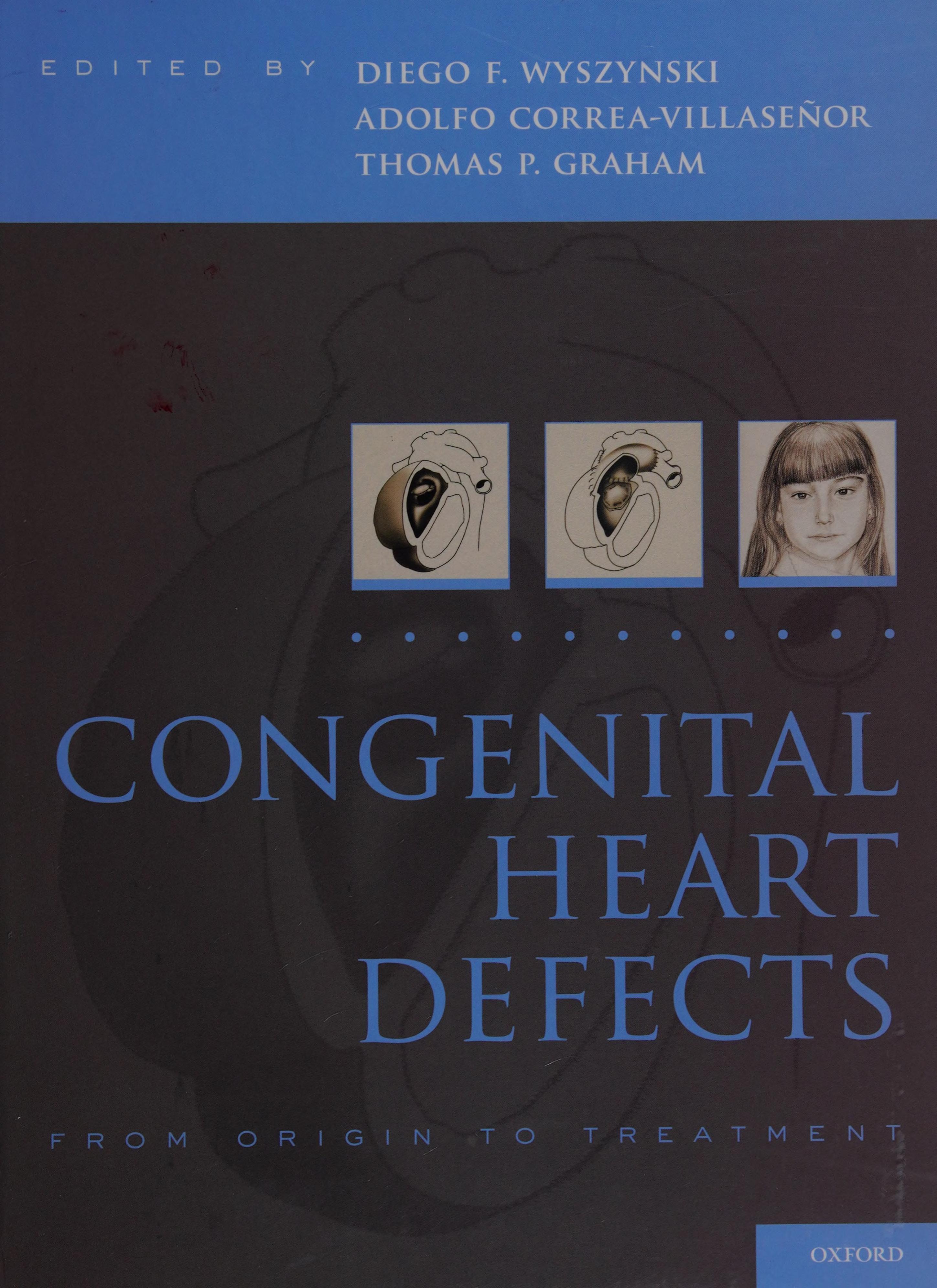Congenital Heart Defects: From Origin To Treatment