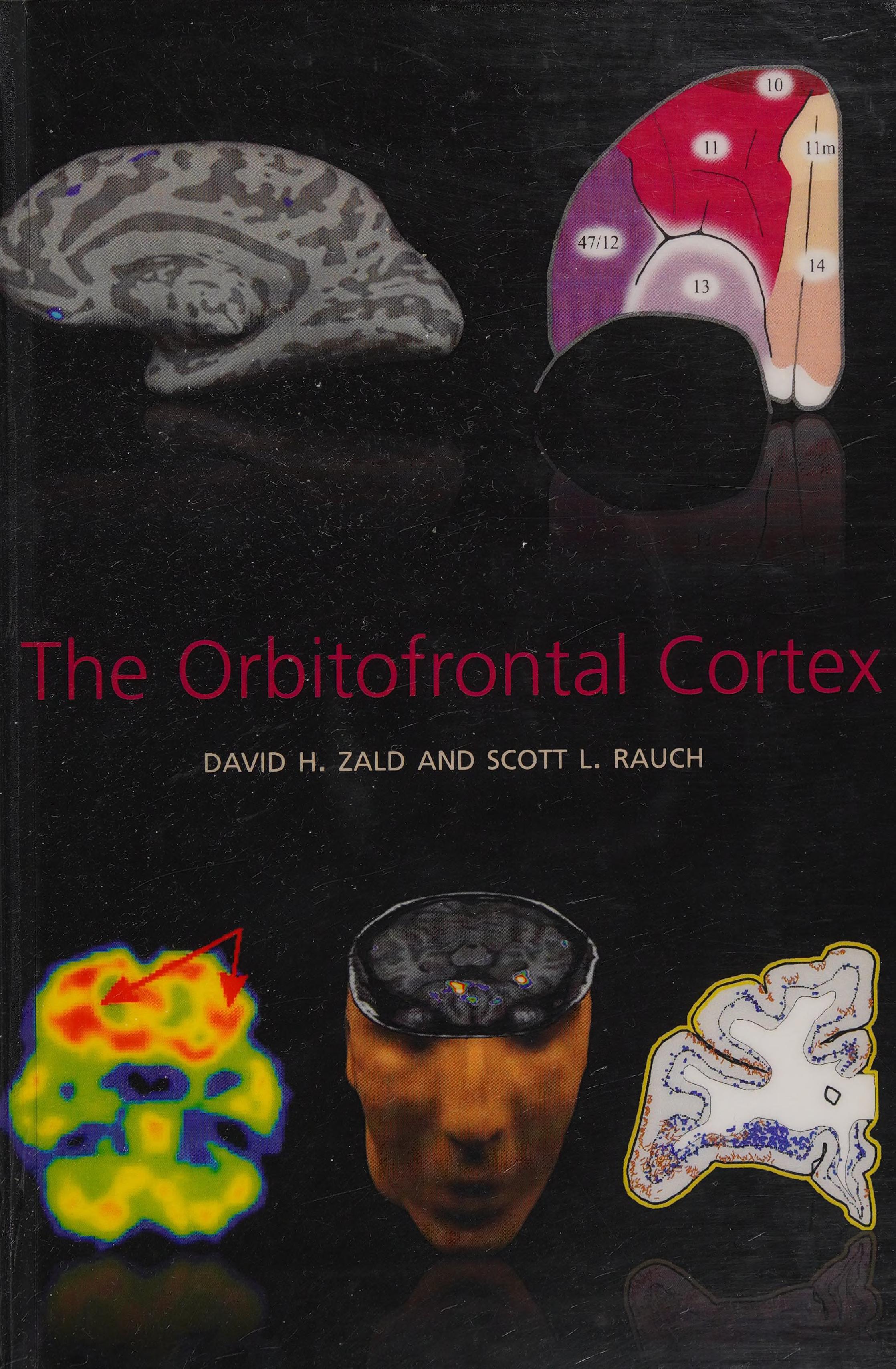 The Orbitofrontal Cortex