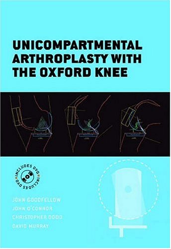 Unicompartmental Arthroplasty with the Oxford Knee