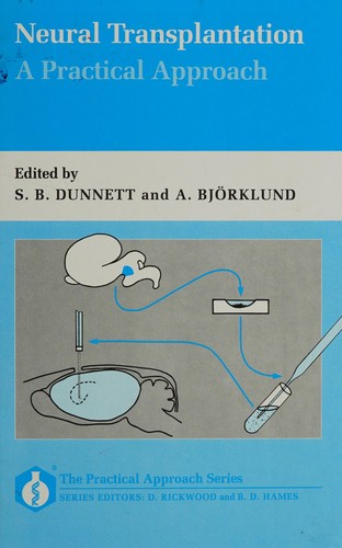Neural Transplantation: A Practical Approach