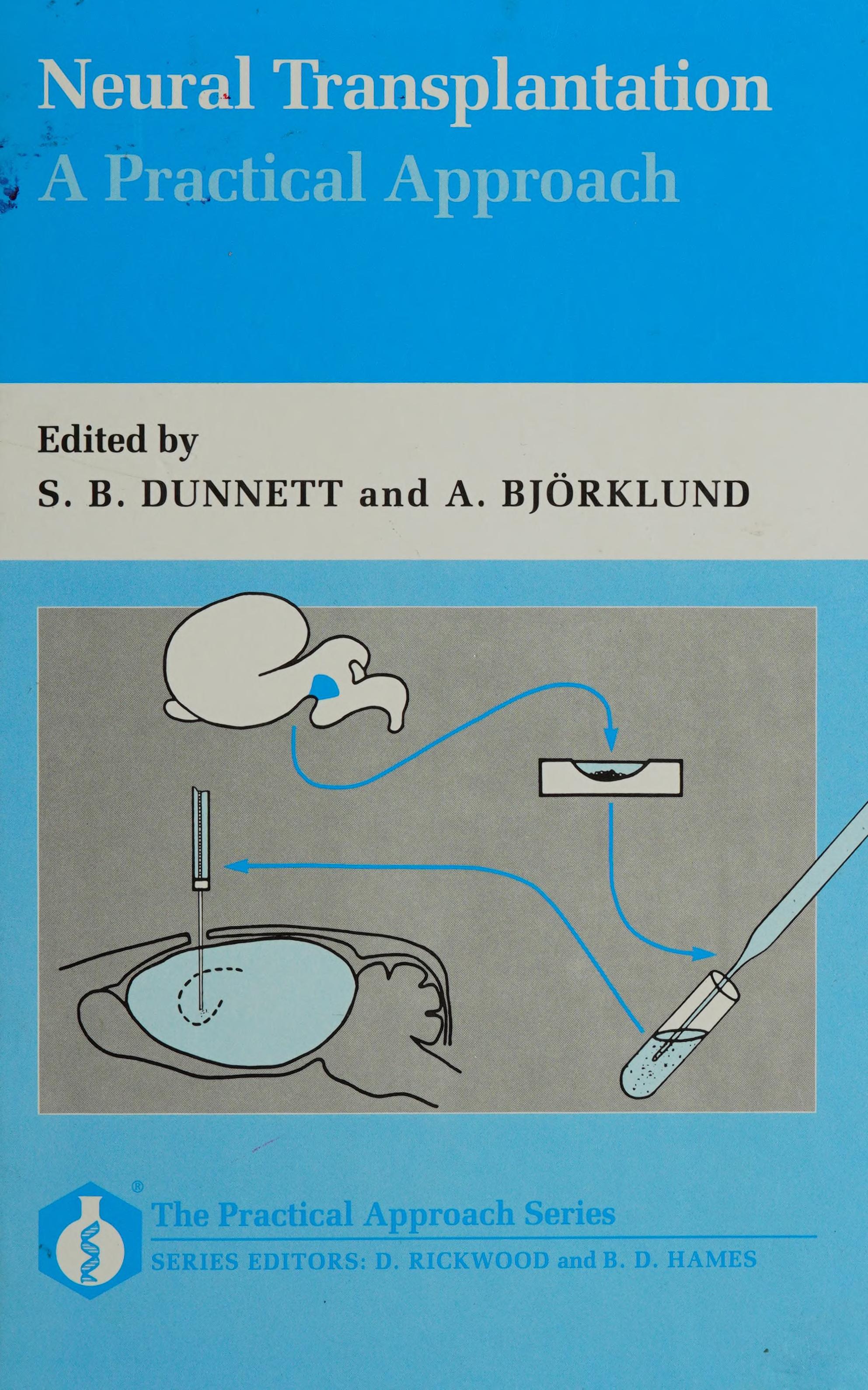 Neural Transplantation: A Practical Approach