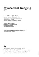 Myocardial Imaging