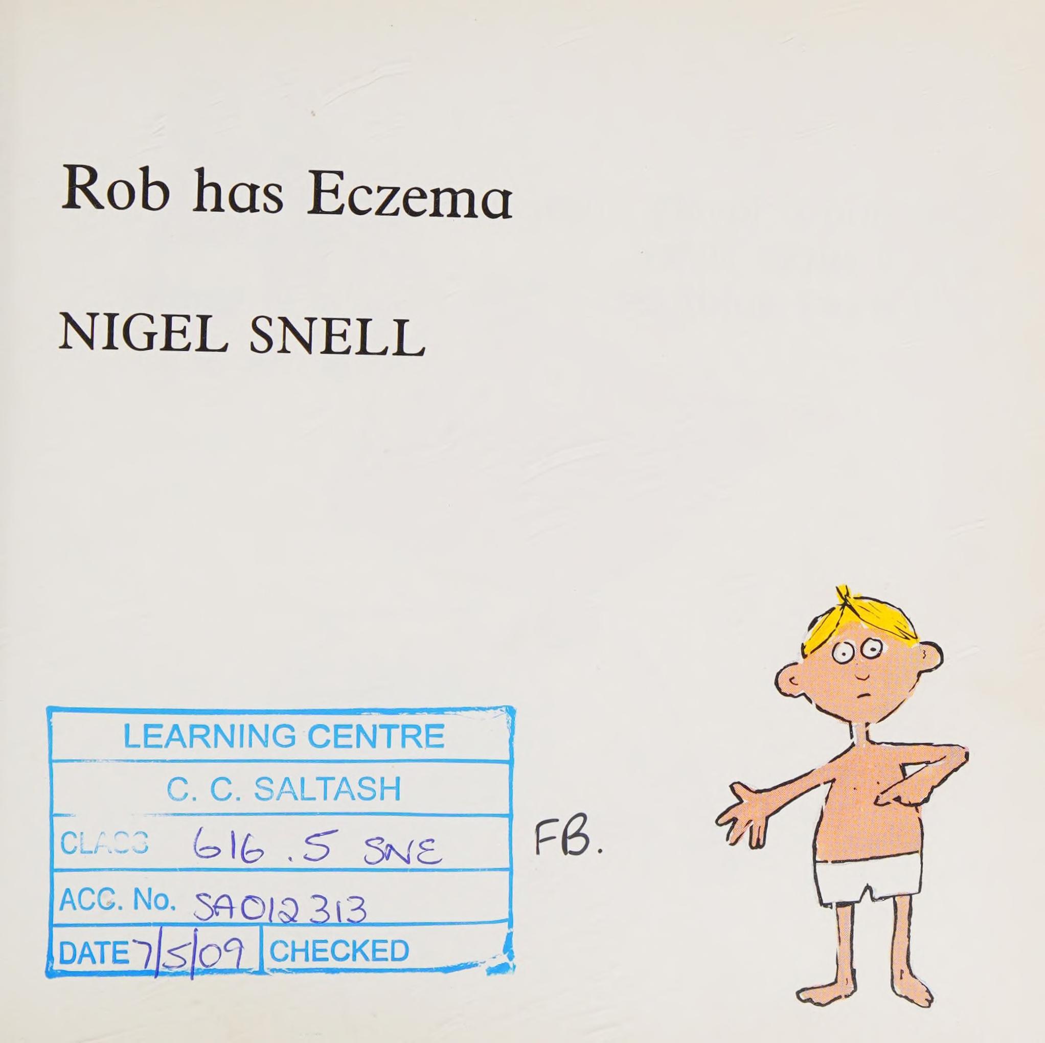 Rob Has Eczema