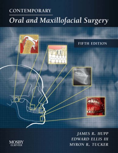 Contemporary Oral And Maxillofacial Surgery