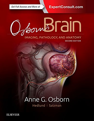 Osborn s Brain