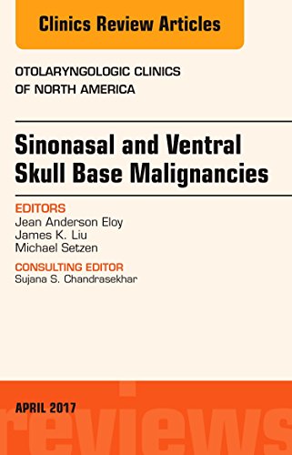 Sinonasal and Ventral Skull Base Malignancies an Issue of Otolaryngologic Clinics of North America