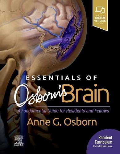 Essentials of Osborn's Brain: A Fundamental Guide for Residents and Fellows, 1e