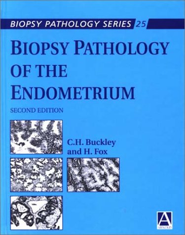 Biopsy Pathology of the Endometrium Hodder Arnold Publication