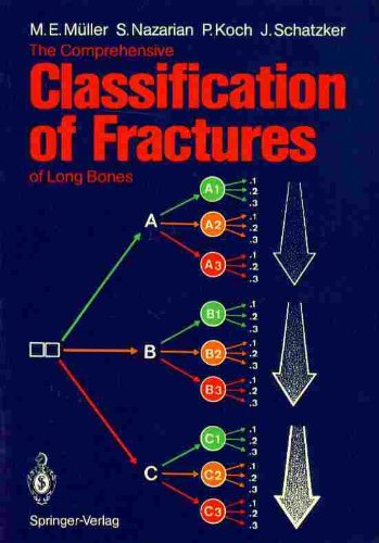 The Comprehensive Classification of Fractures of Long Bones