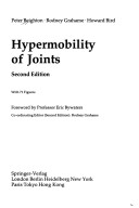 Hypermobility of Joints