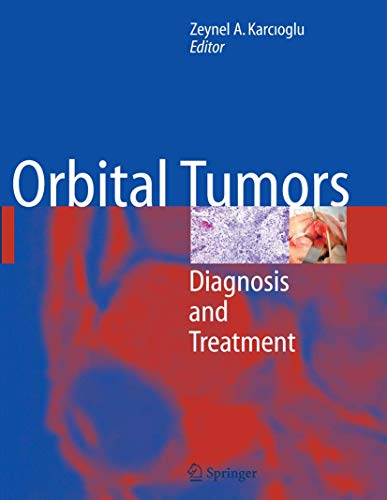 Orbital Tumors: Diagnosis And Treatment