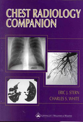 Chest Radiology Companion: Methods, Guidelines, and Imaging Fundamentals