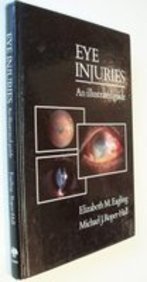 Eye Injuries: An Illustrated Guide