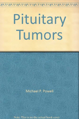 Management of Pituitary Tumours