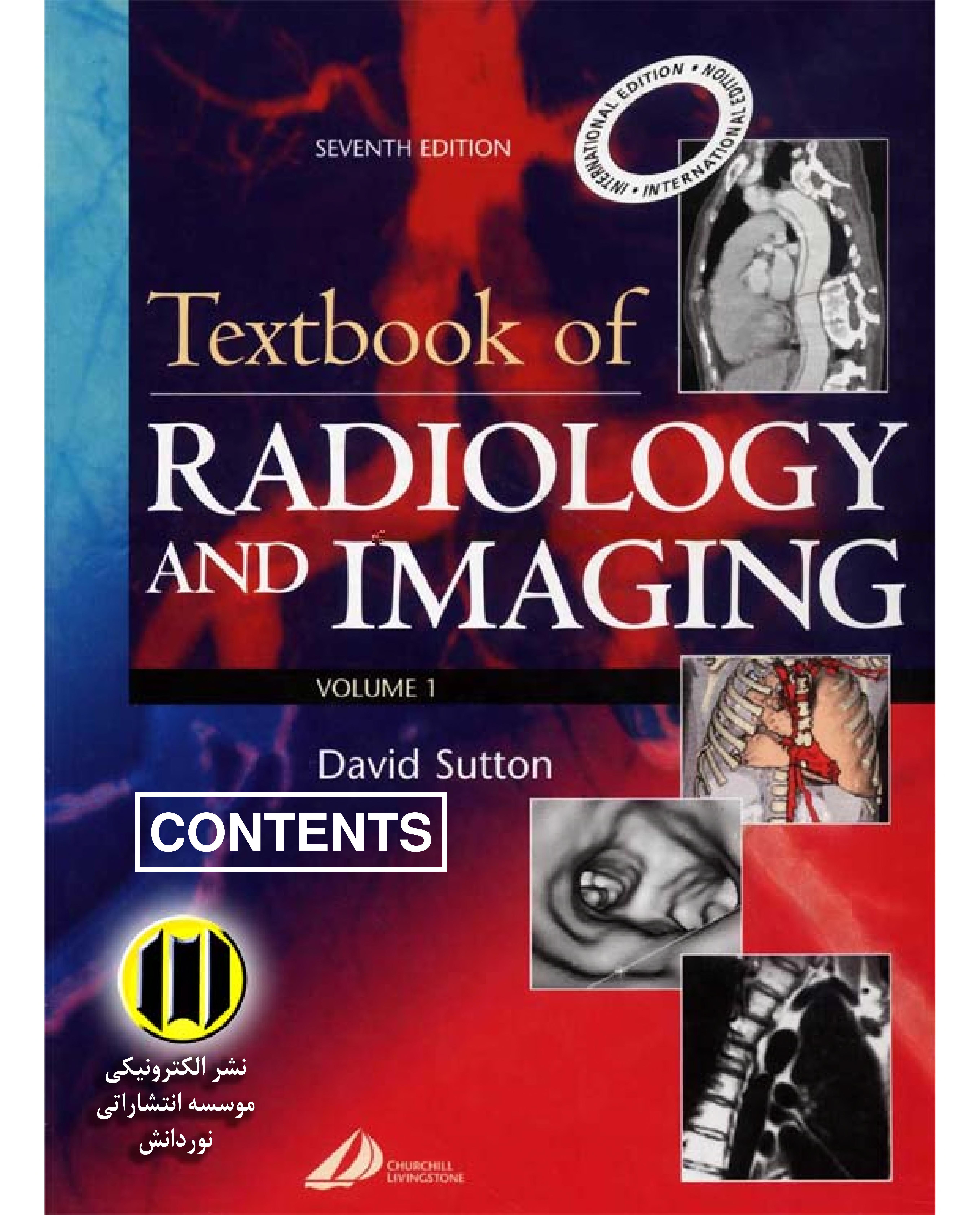Textbook Of Radiology & Imaging Ise