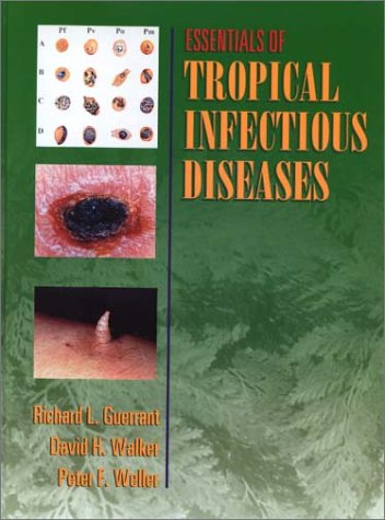 Essentials Of Tropical Infectious Diseases