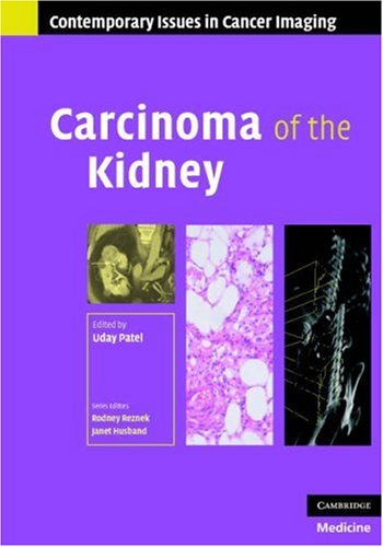 Carcinoma of the Kidney