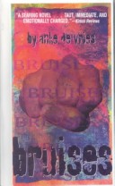 Bruises