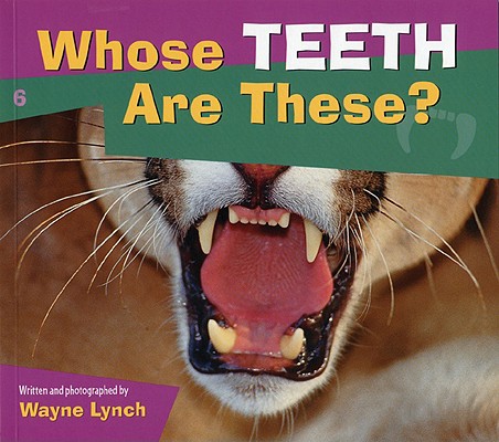 Whose Teeth Are These? (Whose....Is This?)