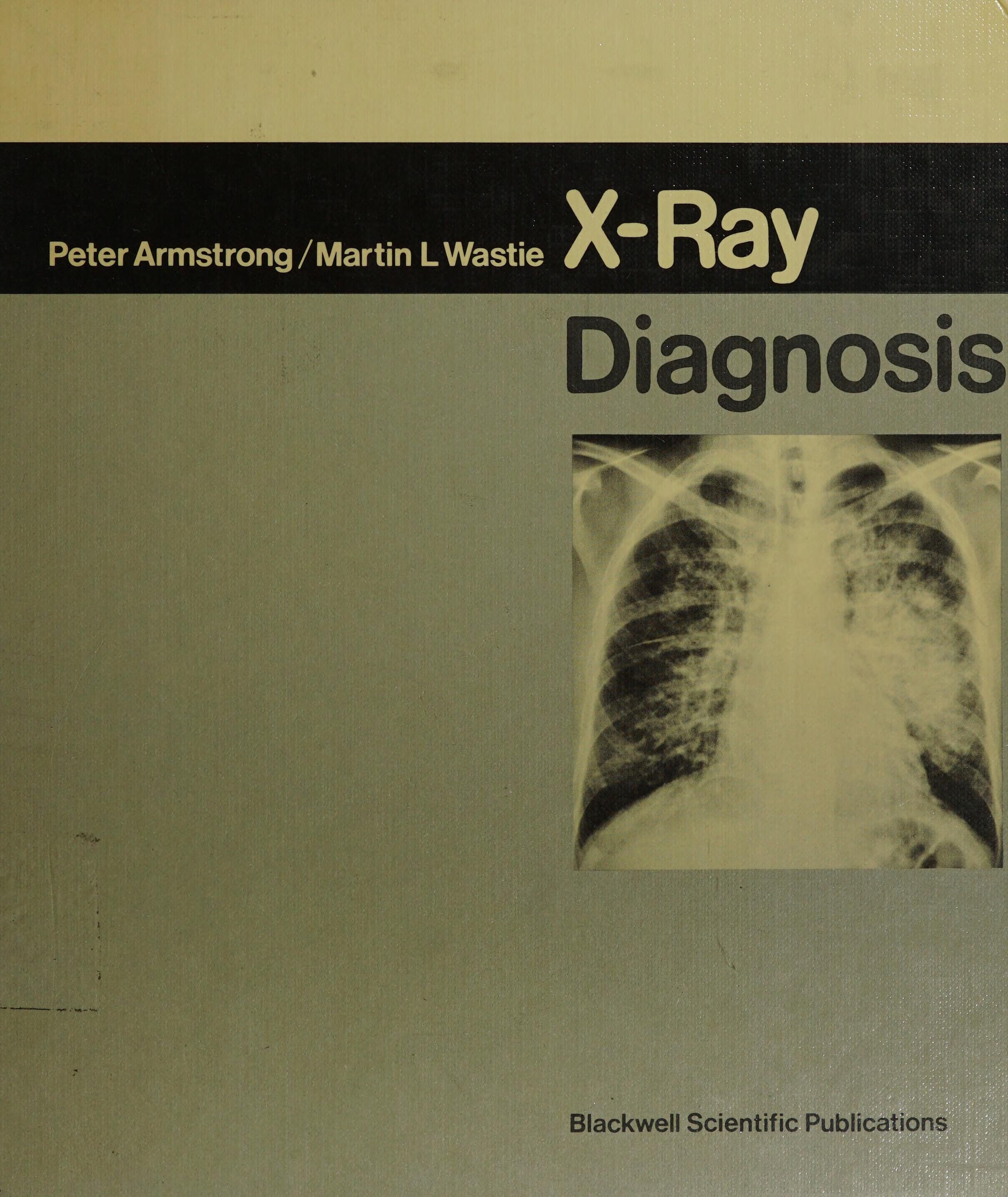 X-Ray Diagnosis