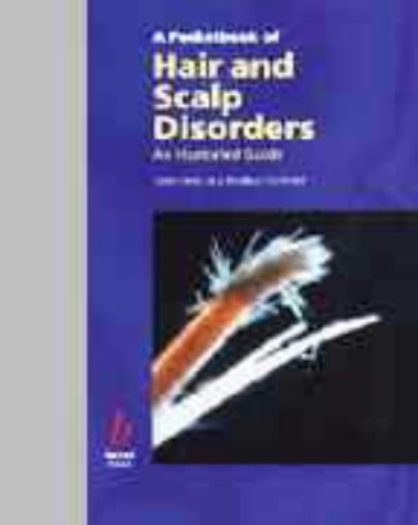 A Pocketbook of Hair and Scalp Disorders