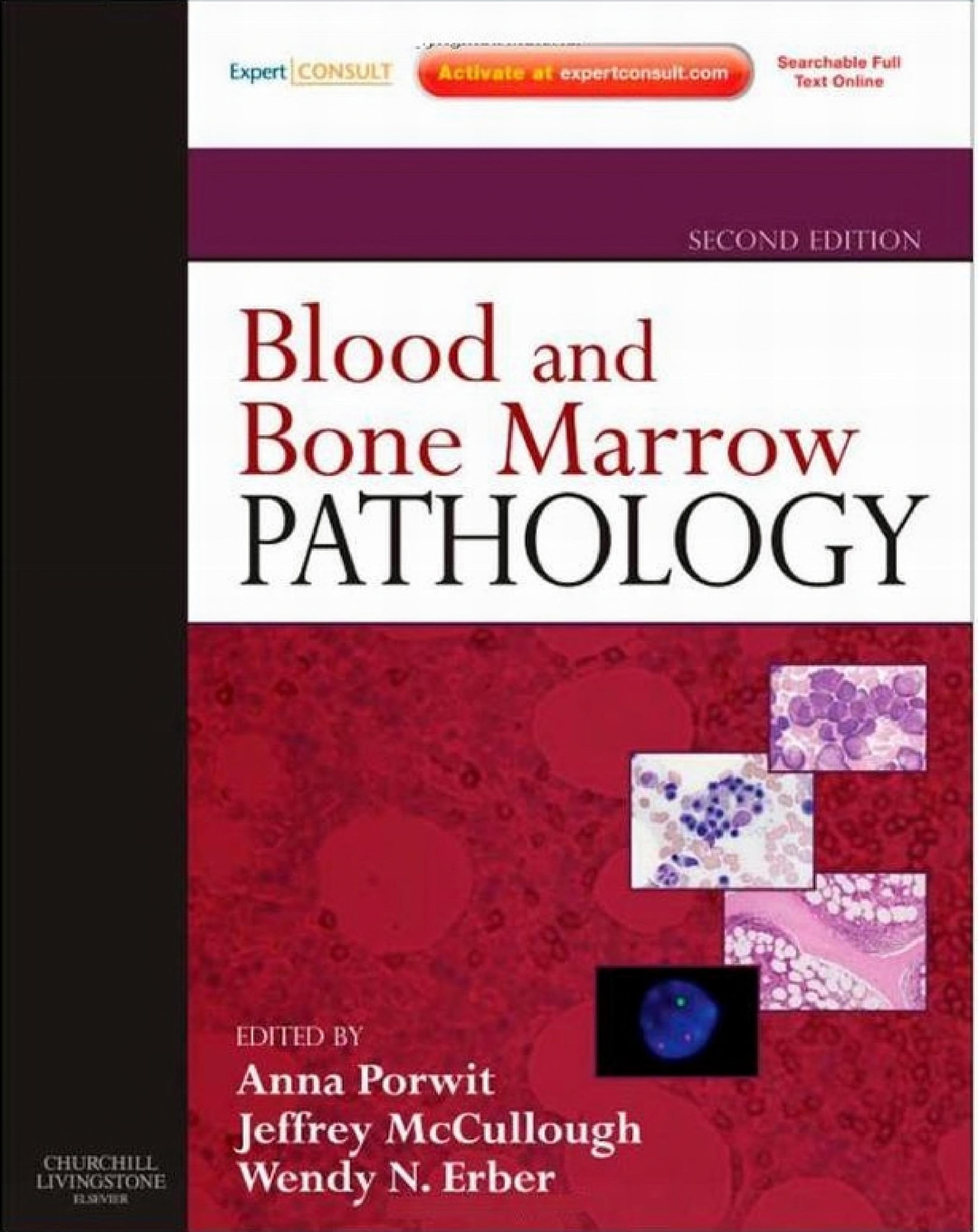 Blood And Bone Marrow Pathology: Expert Consult: Online And Print