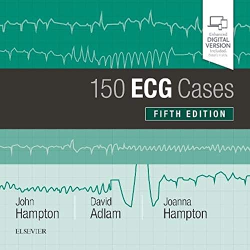 150 ECG Cases, 5e