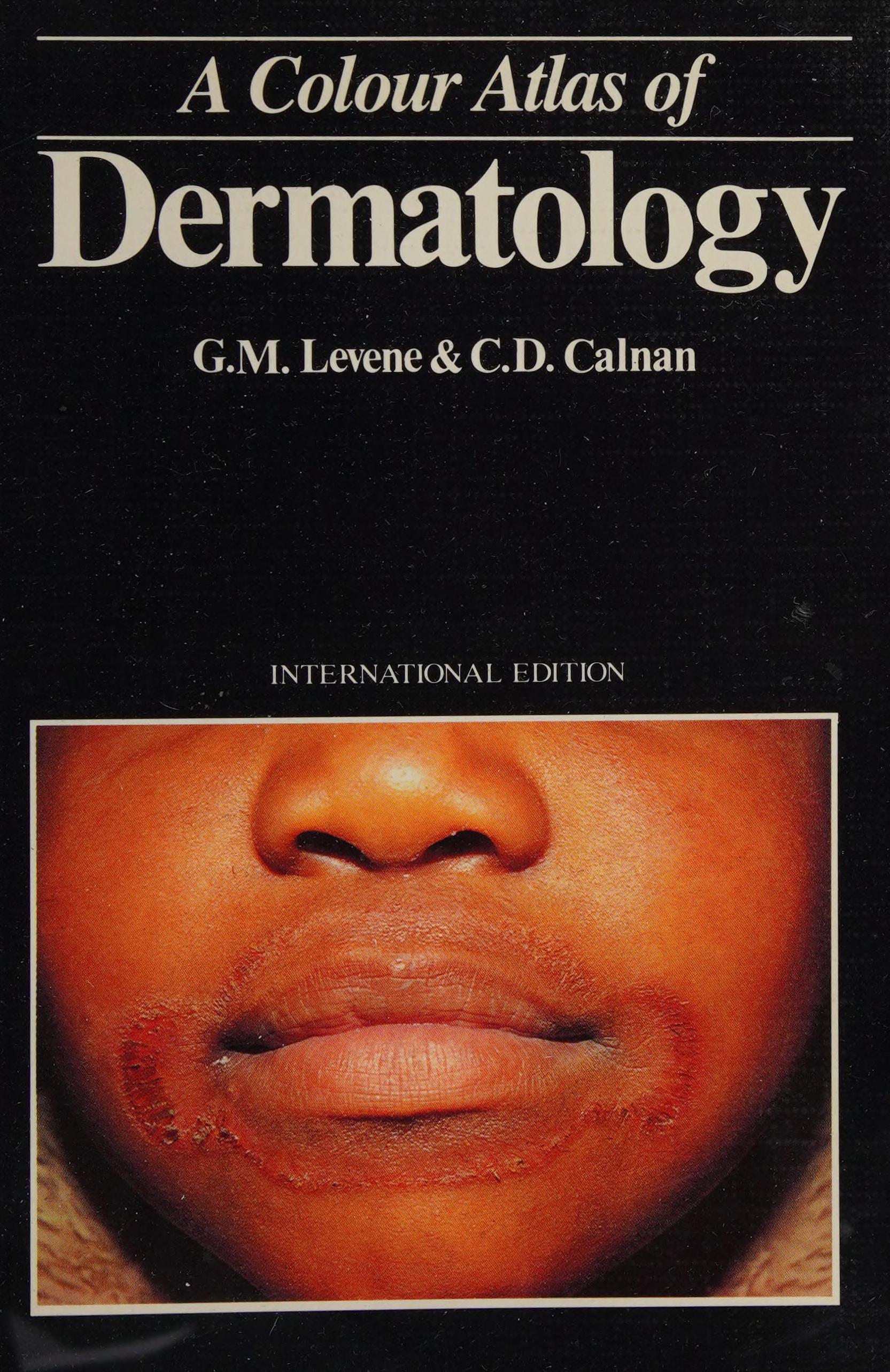 Colour Atlas of Dermatology