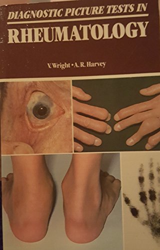 Diagnostic Picture Tests In Rheumatology