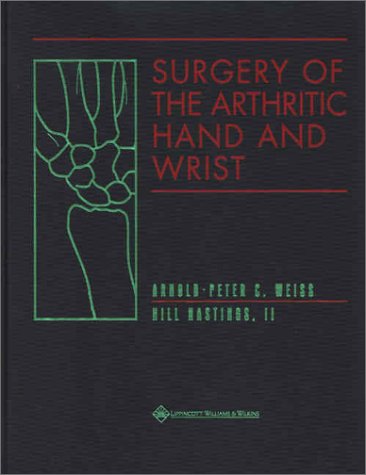 Surgery Of The Arthritic Hand And Wrist