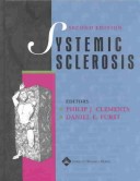 Systemic Sclerosis