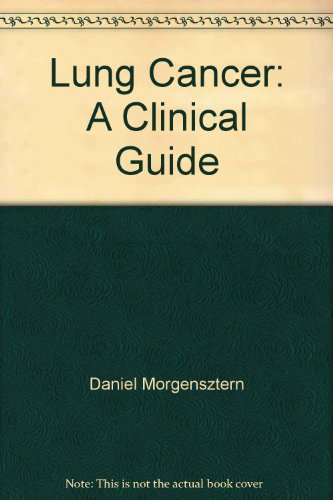 Lung Cancer: A Clinical Guide