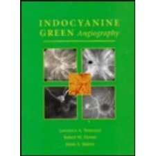 Indocyanine Green Angiography