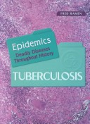 Tuberculosis