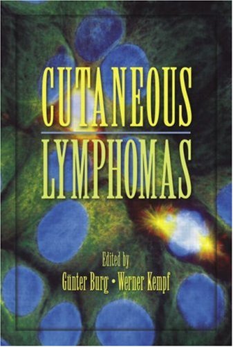 Cutaneous Lymphomas Basic and Clinical Dermatology
