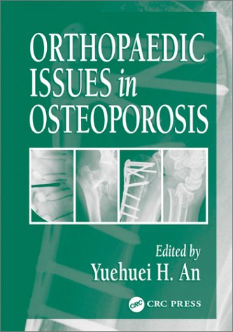 Orthopaedic Issues In Osteoporosis