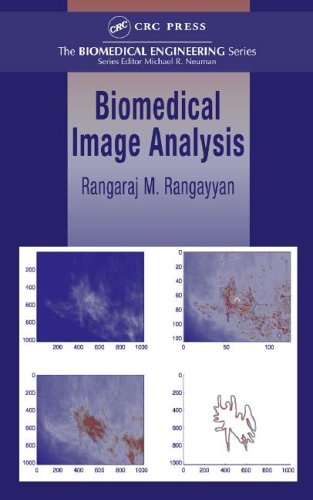 Biomedical Image Analysis Biomedical Engineering