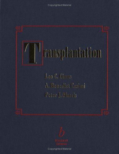 Organ Transplantation