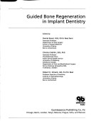 Guided Bone Regeneration in Implant Dentistry