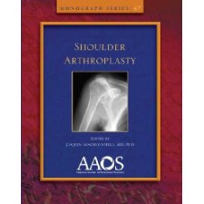 Shoulder Arthroplasty
