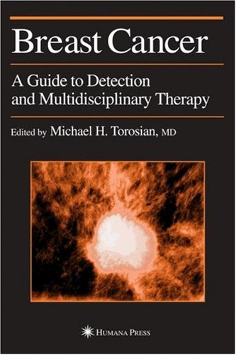 Breast Cancer: A Guide To Detection And Multidisciplinary Therapy