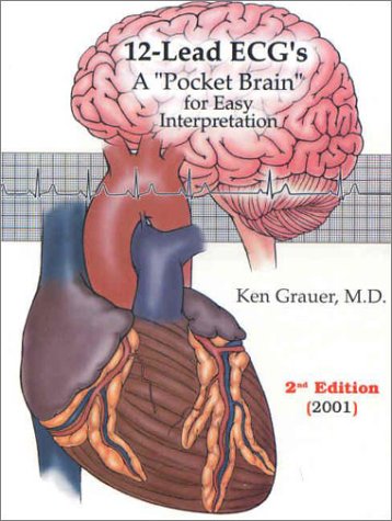 ECG Pocket Guide (Pocket Brain) - ECG Interpretation