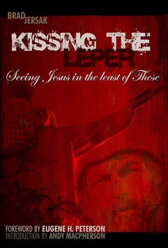 Kissing the Leper