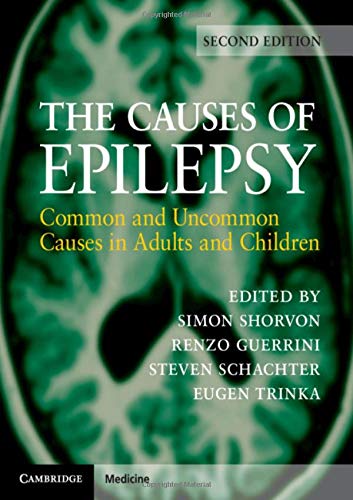 The Causes Of Epilepsy: Common And Uncommon Causes In Adults And Children