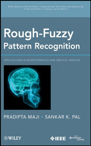 Rough fuzzy pattern recognition
