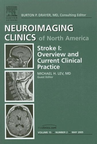 Stroke I: Overview And Current Clinical Practice