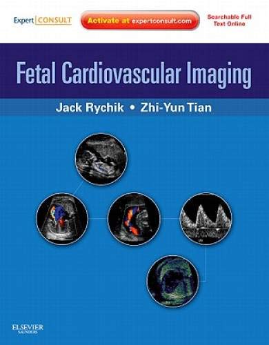 Fetal cardiovascular imaging