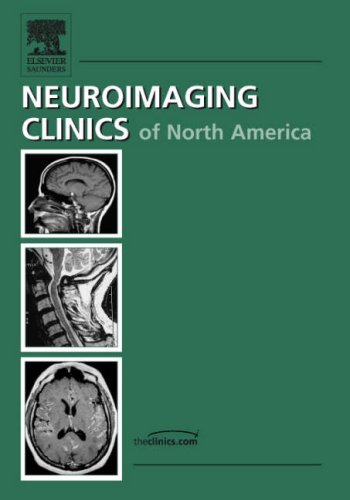 Advanced Pediatric Neuroimaging An Issue of Neuroimaging Clinics The Clinics Radiology