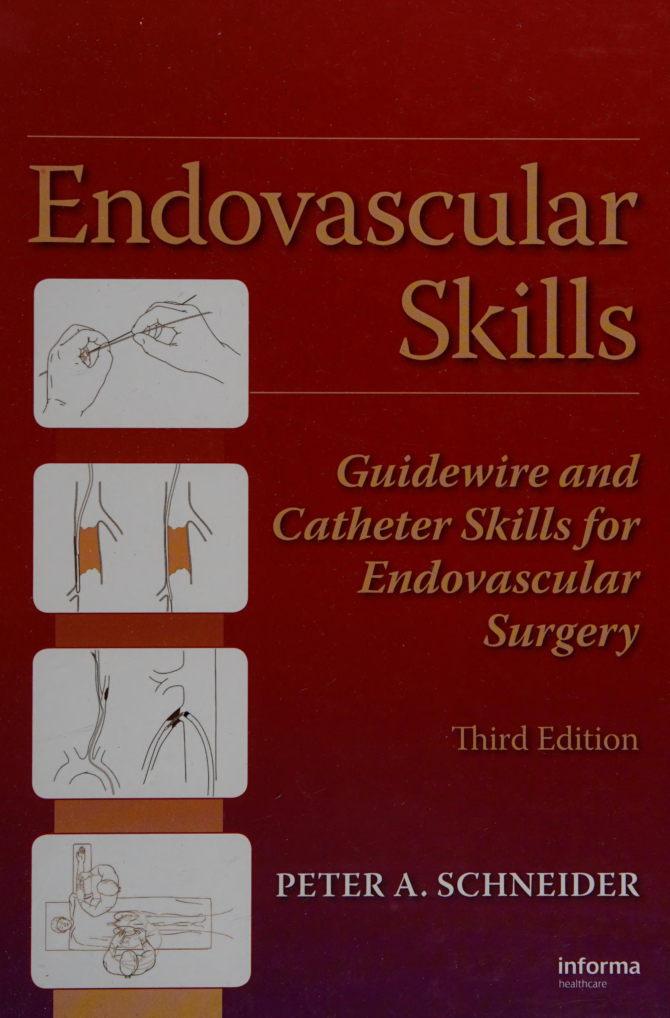 Endovascular Skills